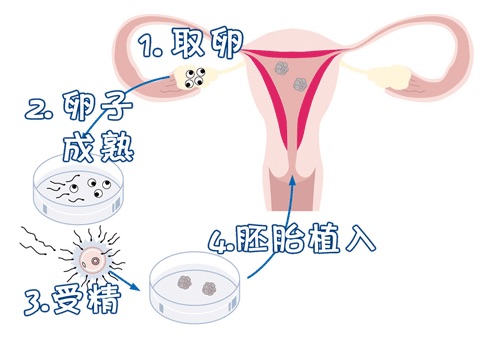 关于供卵代孕公司